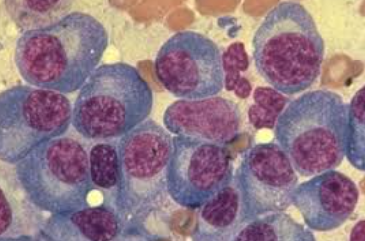 Multiple Myeloma Icon
